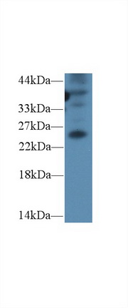 Polyclonal Antibody to Gremlin 1 (GREM1)