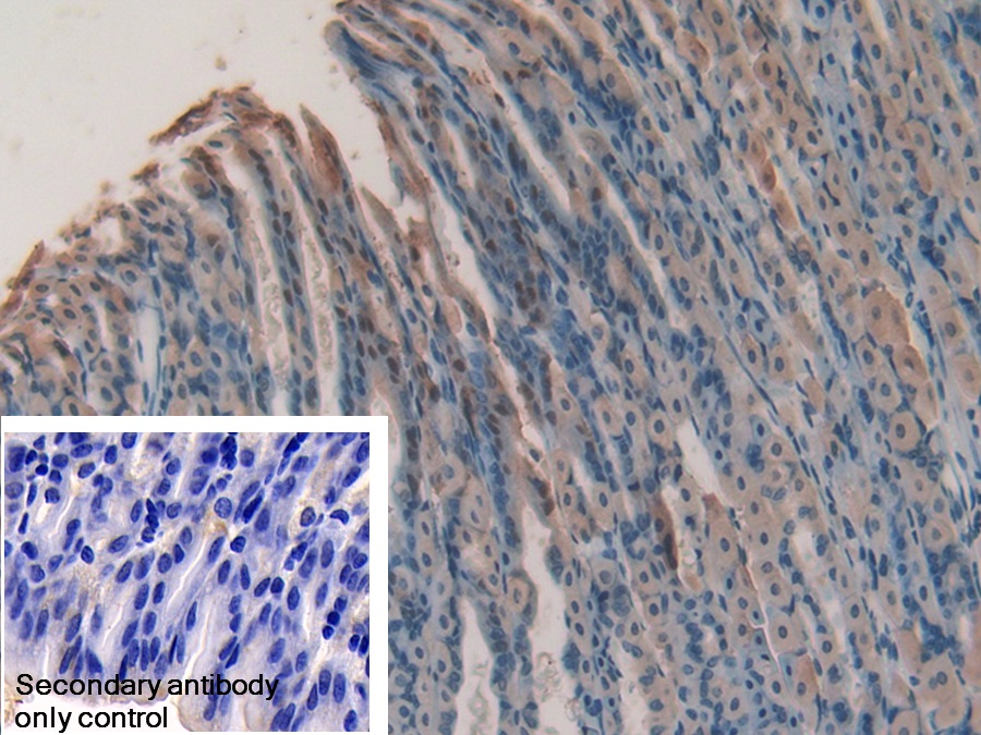 Polyclonal Antibody to Gremlin 1 (GREM1)