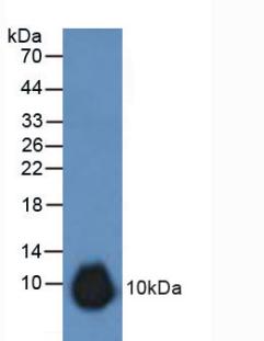 Polyclonal Antibody to Gremlin 1 (GREM1)