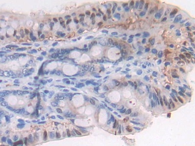 Polyclonal Antibody to Latent Transforming Growth Factor Beta Binding Protein 1 (LTBP1)