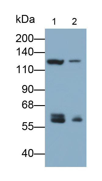 Polyclonal Antibody to Noggin (NOG)