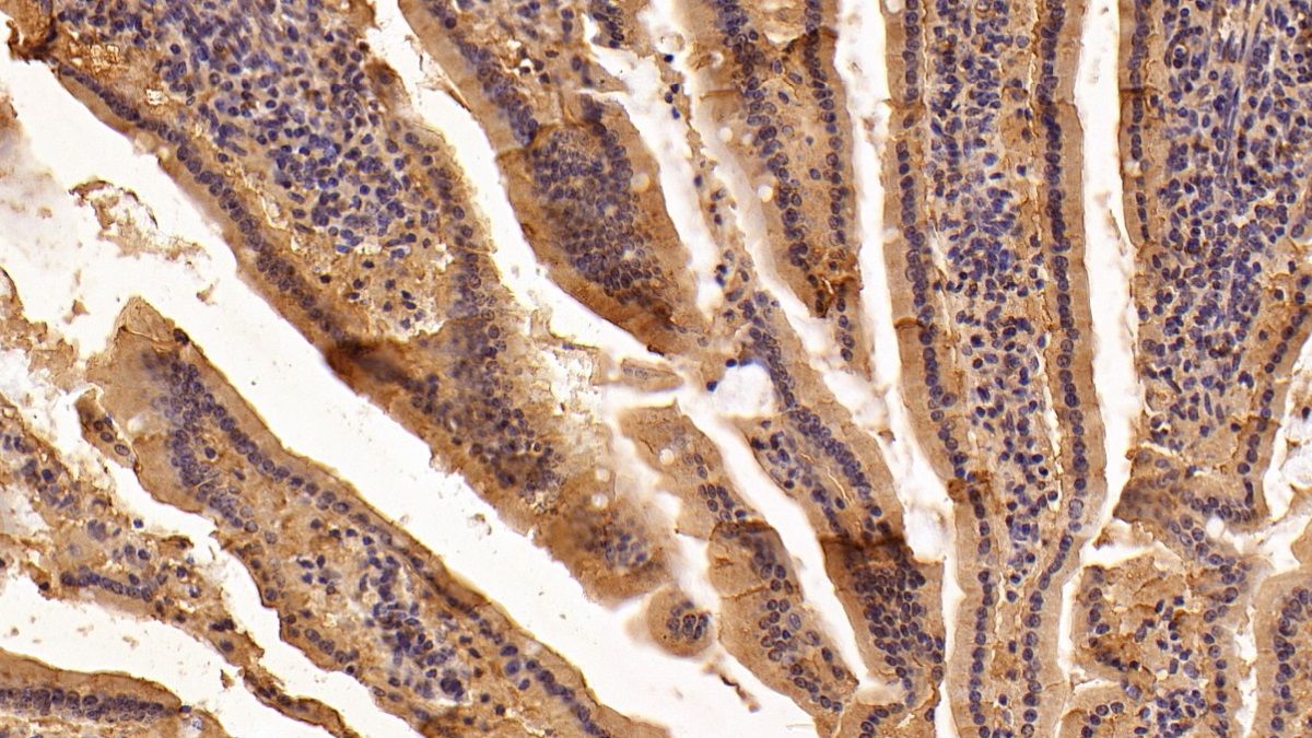 Polyclonal Antibody to Collagen Type XVIII (COL18)