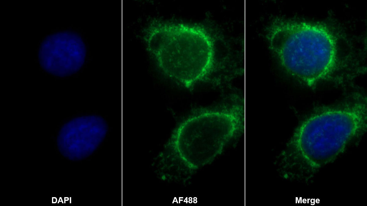 Polyclonal Antibody to Collagen Type XVIII (COL18)