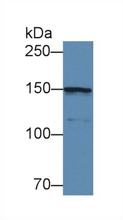 Polyclonal Antibody to Collagen Type IV Alpha 5 (COL4a5)