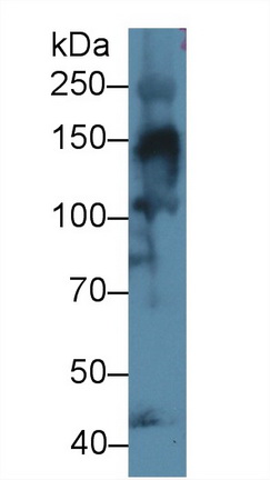 Polyclonal Antibody to Collagen Type IV Alpha 3 (COL4a3)