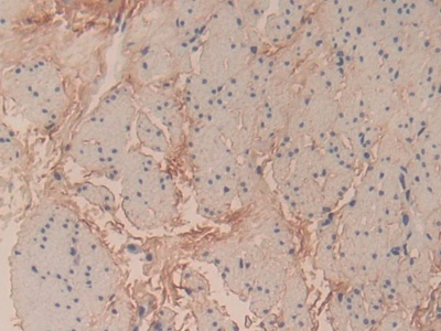 Polyclonal Antibody to Collagen Type VI Alpha 3 (COL6a3)