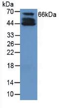 Polyclonal Antibody to Collagen Type X (COL10)