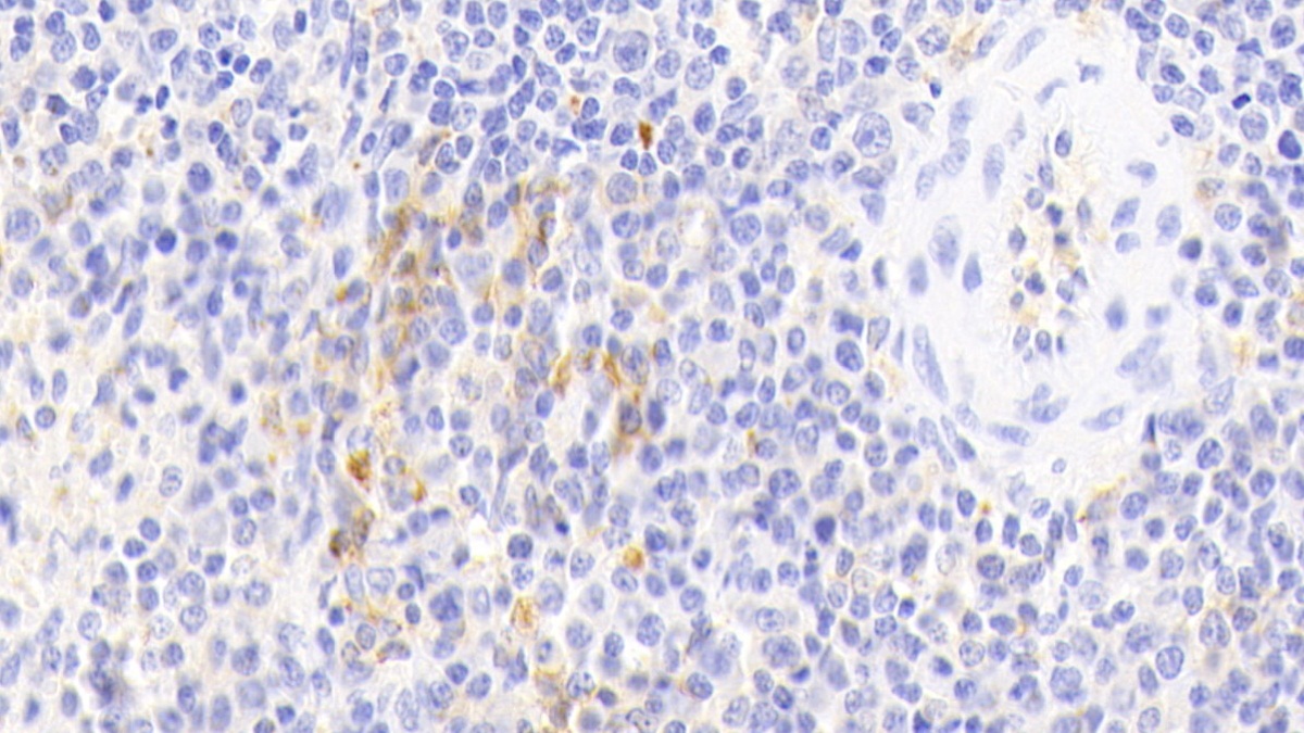 Polyclonal Antibody to HLA Class II Histocompatibility Antigen, DR Alpha Chain (HLA-DRA)