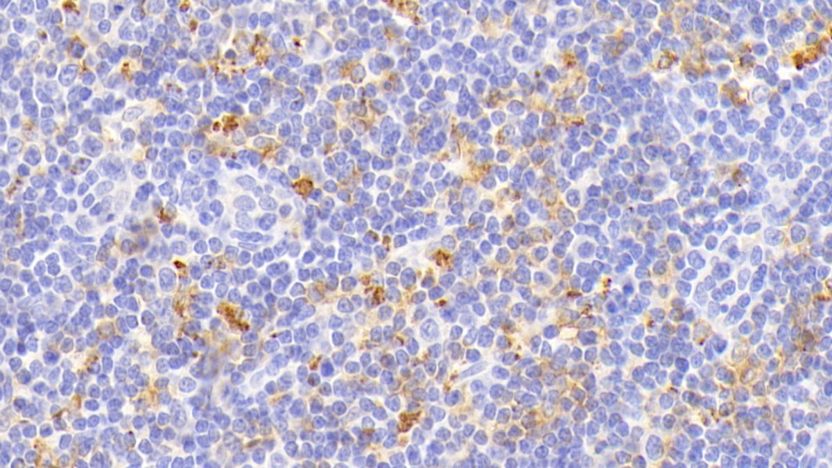 Polyclonal Antibody to HLA Class II Histocompatibility Antigen, DR Alpha Chain (HLA-DRA)