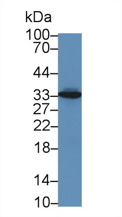 Polyclonal Antibody to HLA Class II Histocompatibility Antigen, DR Alpha Chain (HLA-DRA)