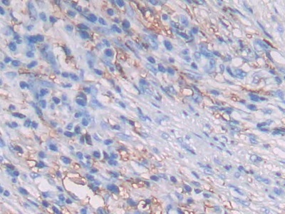 Polyclonal Antibody to HLA Class II Histocompatibility Antigen, DRB1 Beta Chain (HLA-DRB1)