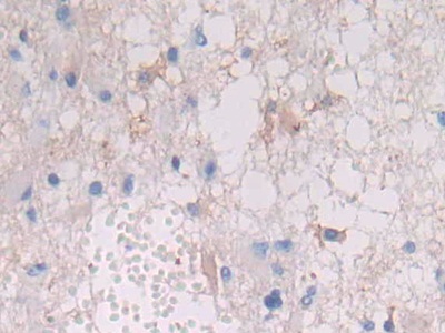 Polyclonal Antibody to HLA Class II Histocompatibility Antigen, DRB1 Beta Chain (HLA-DRB1)