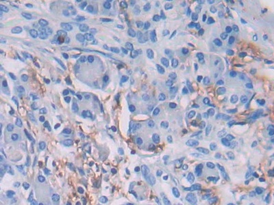 Polyclonal Antibody to HLA Class II Histocompatibility Antigen, DRB1 Beta Chain (HLA-DRB1)