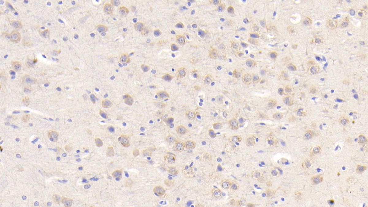 Polyclonal Antibody to Glial Cell Line Derived Neurotrophic Factor Receptor Alpha 2 (GFRa2)