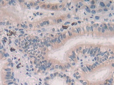 Polyclonal Antibody to Persephin (PSPN)