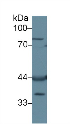 Polyclonal Antibody to Left/Right Determination Factor 1 (LEFTY1)