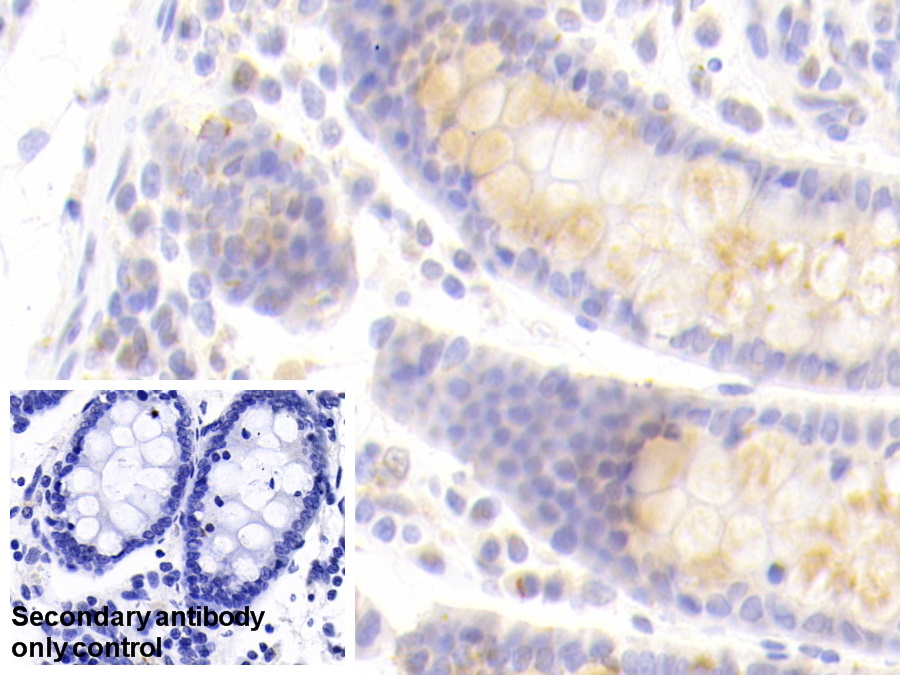 Polyclonal Antibody to Left/Right Determination Factor 1 (LEFTY1)