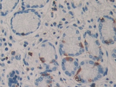 Polyclonal Antibody to Poly A Specific Ribonuclease (PARN)