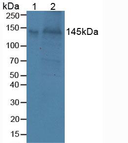 Polyclonal Antibody to Brevican (BCAN)