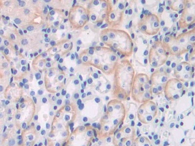 Polyclonal Antibody to Brevican (BCAN)