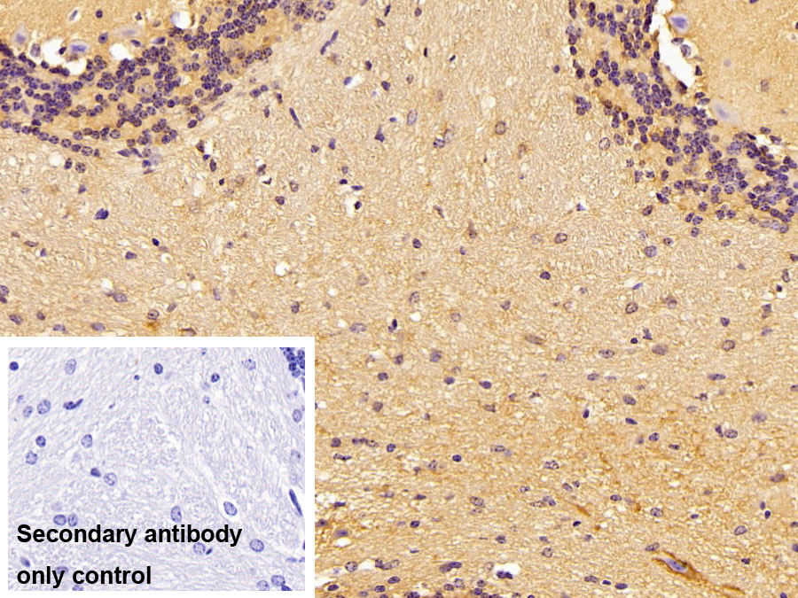 Polyclonal Antibody to Brevican (BCAN)