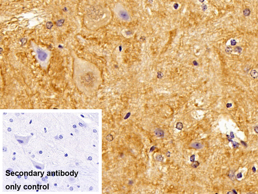 Polyclonal Antibody to Brevican (BCAN)