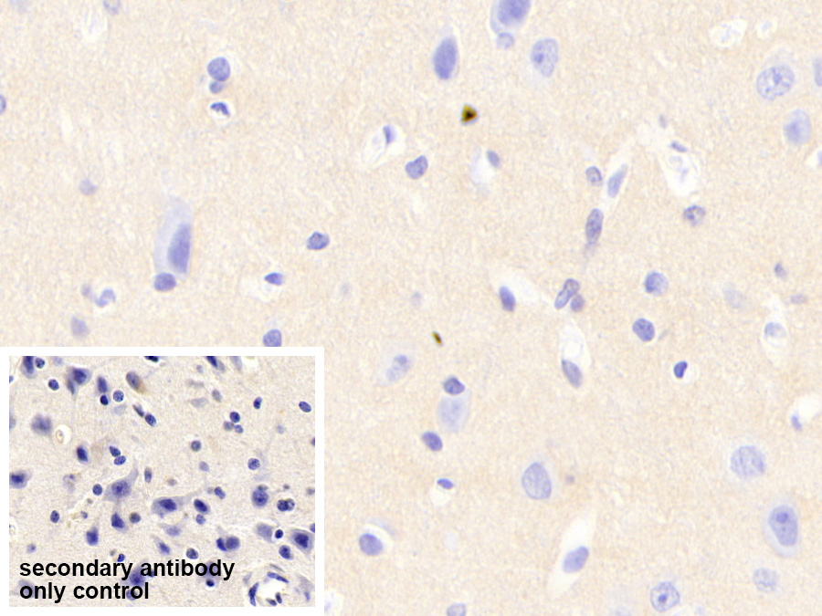 Polyclonal Antibody to Neurocan (NCAN)