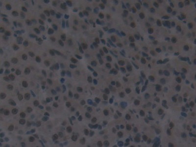 Polyclonal Antibody to Interferon Regulatory Factor 2 (IRF2)