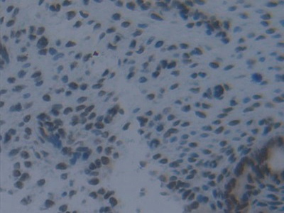 Polyclonal Antibody to Interferon Regulatory Factor 2 (IRF2)