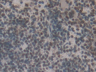 Polyclonal Antibody to Interferon Regulatory Factor 2 (IRF2)