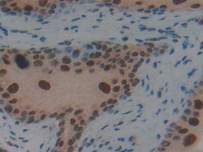 Polyclonal Antibody to Interferon Regulatory Factor 2 (IRF2)