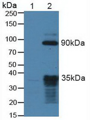 Polyclonal Antibody to Tropomyosin Receptor Kinase B (TrkB)