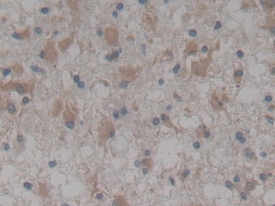 Polyclonal Antibody to Neurotrophic Tyrosine Kinase Receptor Type 3 (NTRK3)