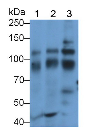 Polyclonal Antibody to Neurotrophic Tyrosine Kinase Receptor Type 3 (NTRK3)