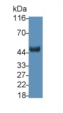 Polyclonal Antibody to Ciliary Neurotrophic Factor Receptor (CNTFR)