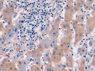 Polyclonal Antibody to C-Met (MET)