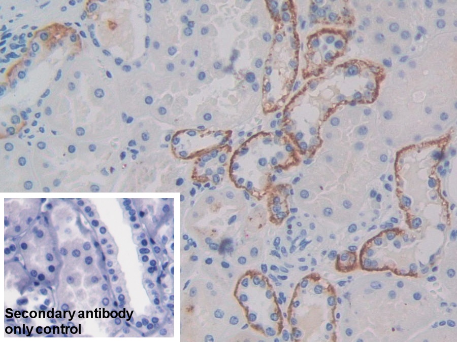 Polyclonal Antibody to C-Met (MET)