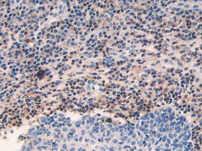 Polyclonal Antibody to Beta Adrenergic Receptor Kinase (BARK)