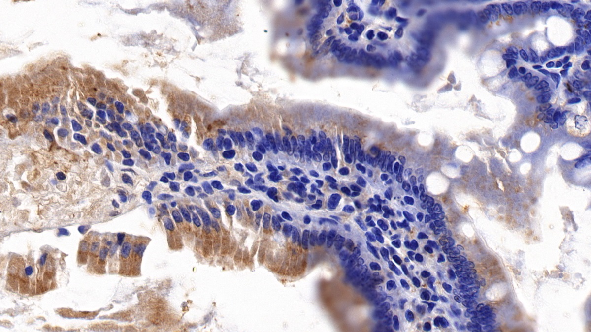 Polyclonal Antibody to Axis Inhibition Protein (AXIN)