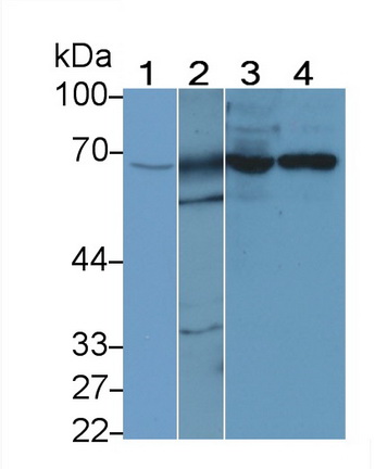 Polyclonal Antibody to G Protein Coupled Receptor Kinase 6 (GRK6)