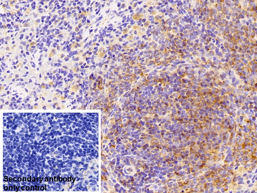 Polyclonal Antibody to G Protein Coupled Receptor Kinase 6 (GRK6)