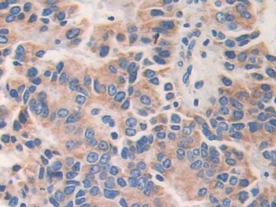 Polyclonal Antibody to A Kinase Anchor Protein 11 (AKAP11)