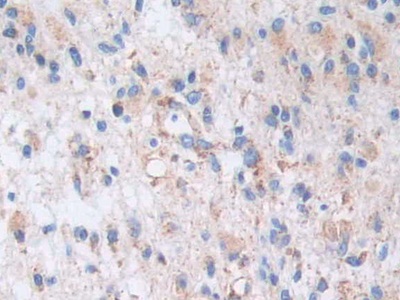 Polyclonal Antibody to A Kinase Anchor Protein 11 (AKAP11)