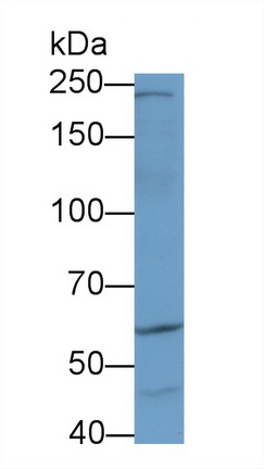 Polyclonal Antibody to A Kinase Anchor Protein 11 (AKAP11)