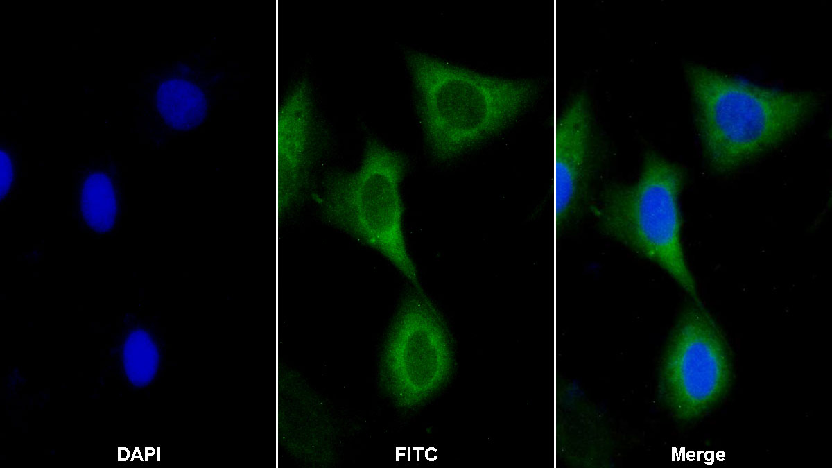 Polyclonal Antibody to A Kinase Anchor Protein 11 (AKAP11)