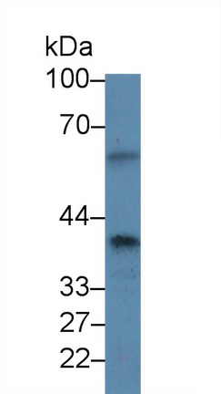 Polyclonal Antibody to Protein Phosphatase 1, Catalytic Subunit Alpha Isoform (PPP1Ca)