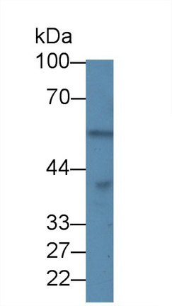 Polyclonal Antibody to Protein Phosphatase 1, Catalytic Subunit Alpha Isoform (PPP1Ca)