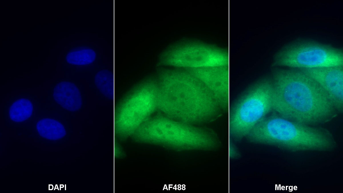 Polyclonal Antibody to Presenilin 1 (PSEN1)