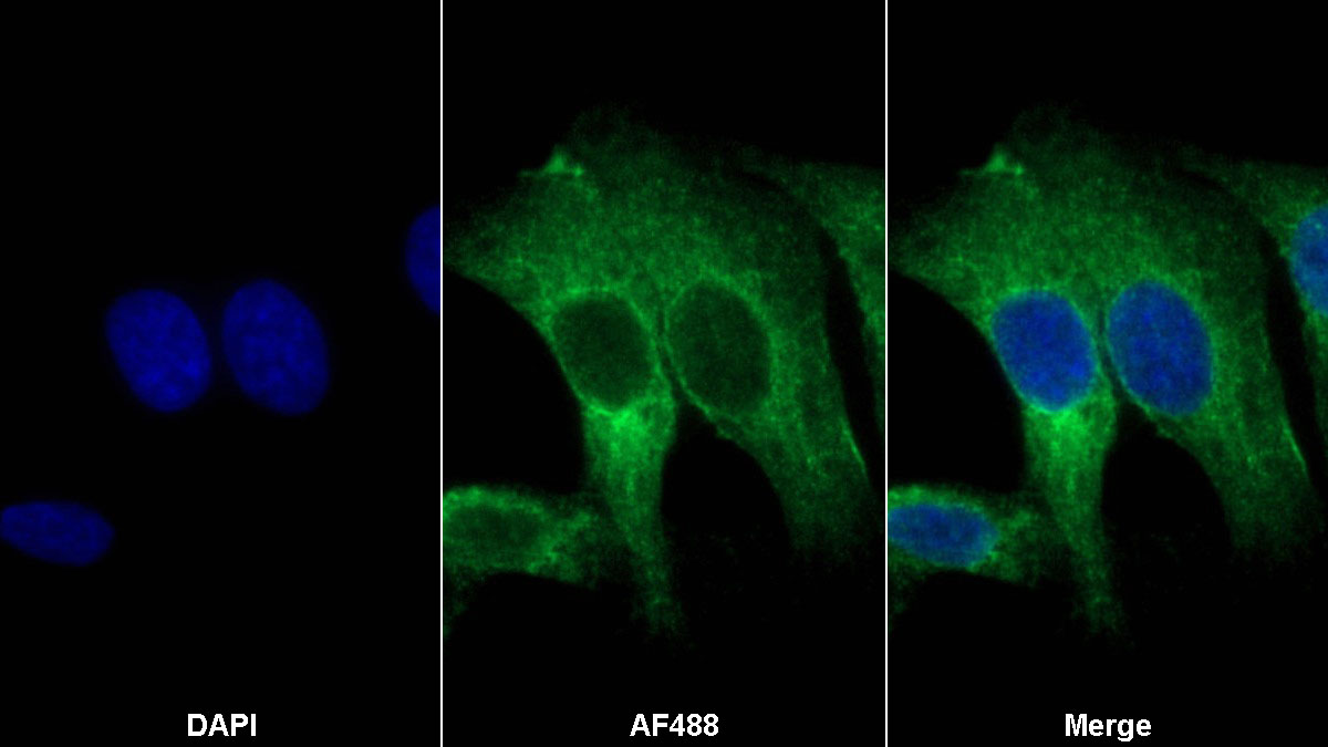 Polyclonal Antibody to Catenin Alpha 1 (CTNNa1)