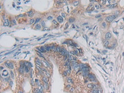 Polyclonal Antibody to Desmoplakin (DSP)